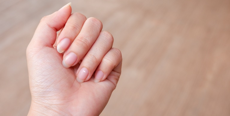 Photo for blog article titled Do your fingernails look like this? Signs of zinc deficiency